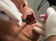 Infection dentaire : causes, symptômes, traitement