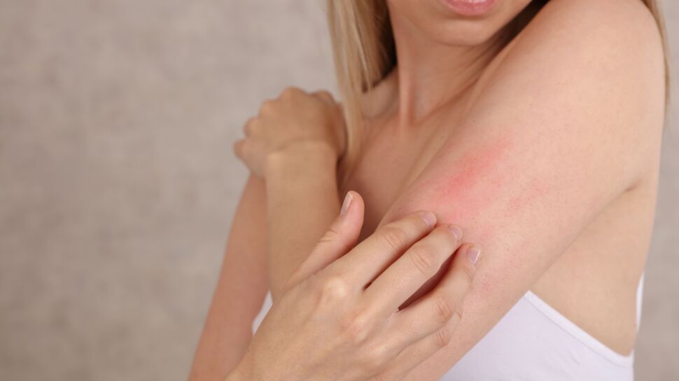 Maladies de peau : les signes à détecter, comment réagir et qui consulter