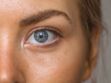 Kératoconjonctivite : symptômes et traitements de ce problème oculaire
