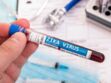Zika : les symptômes caractéristiques de ce virus transmis par certains moustiques