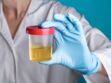ECBU : en quoi consiste l’examen et ce qu’il faut savoir avant de faire des analyses d’urines