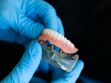 Prothèse dentaire (fixe, amovible) : différents types, pose, prix, remboursement