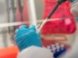 
HCirV-1 : quel est ce nouveau virus qui s’attaque au foie, découvert par des chercheurs français ?