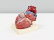 Insuffisance cardiaque : les différents stades de la maladie