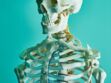 Ostéomalacie : causes, symptômes et traitements de cette pathologie osseuse
