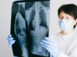 Asbestose : symptômes et traitements de cette lésion pulmonaire causée par l’amiante