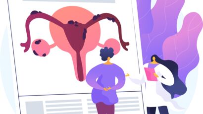 Uterine fibroids: what are the different treatments? 