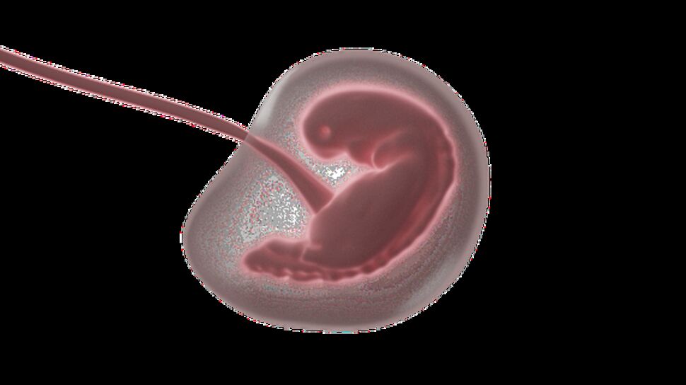 Embryon : définition, différence avec le foetus, développement