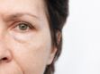 Hypertonie oculaire : symptômes et prise en charge de cette élévation de la tension dans l'œil