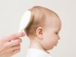 Bébé a des croûtes sur le cuir chevelu : peut-on les enlever et comment ?