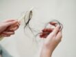 Alopécie : définition, causes, prévention, traitement, comment lutter contre cette perte accélérée des cheveux ?