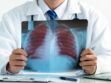 Cancer du poumon non à petites cellules : symptômes, diagnostic, traitements