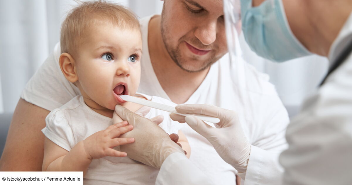 Muguet chez le bébé : causes, symptômes, diagnostic, traitement, durée