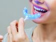 Blanchiment des dents : dans quels cas peut-on y avoir recours et à quoi s'attendre ? Un dentiste répond