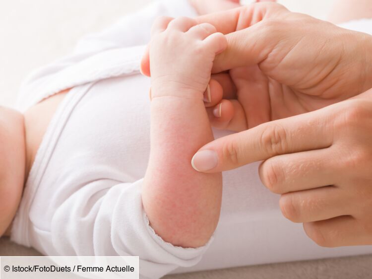 Eczéma chez bébé : comment le prévenir et quels sont les facteurs favorisants ?