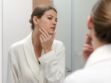 Pourquoi des poils poussent sur les joues à la ménopause et comment s'en débarrasser ? Une dermatologue répond