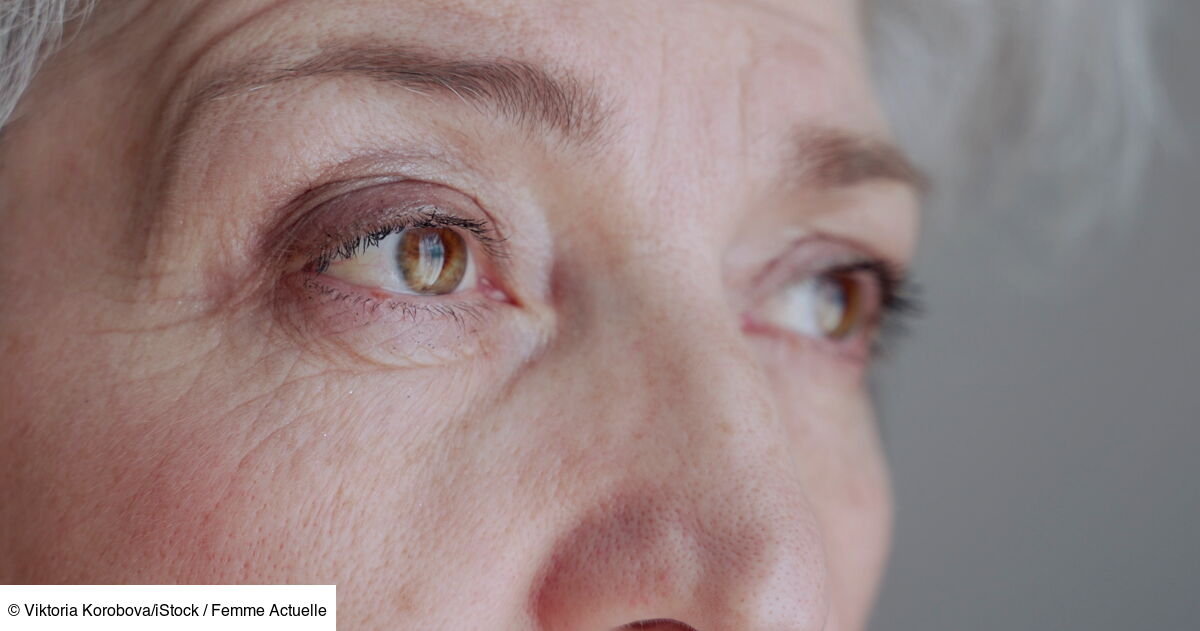 Mes yeux changent de couleur en vieillissant, estce normal ? Femme — free download