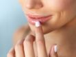 Comment éviter d’avoir les coins des lèvres gercés ? Les conseils d’une dermatologue 