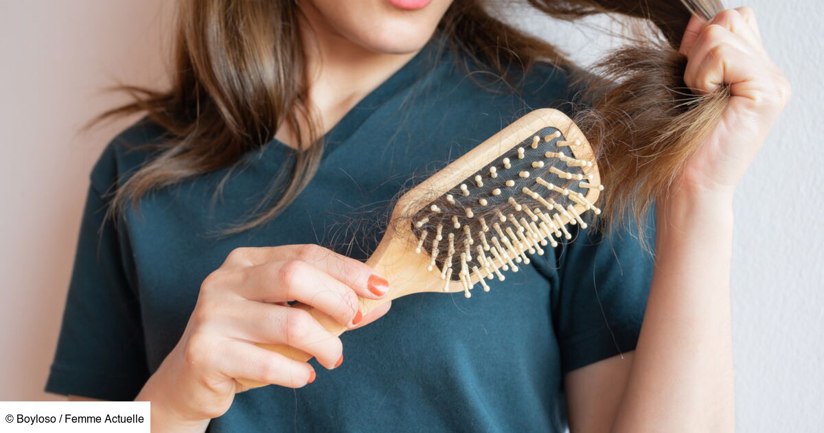 Découvrez les 2 causes les plus fréquentes de la perte de cheveux ...