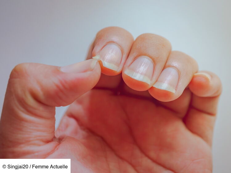 Comment soigner et renforcer des ongles cassants ? Femme Actuelle Le MAG — free download