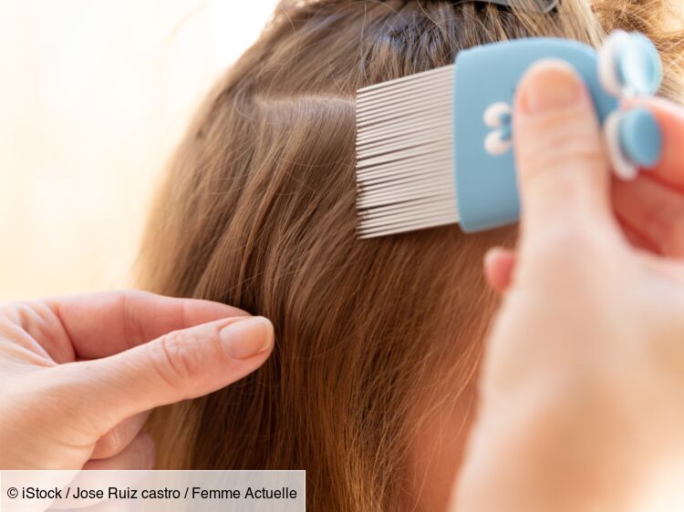 Quel Type De Cheveux Attire Les Poux Comment se débarrasser des poux ? Les meilleures techniques : Femme