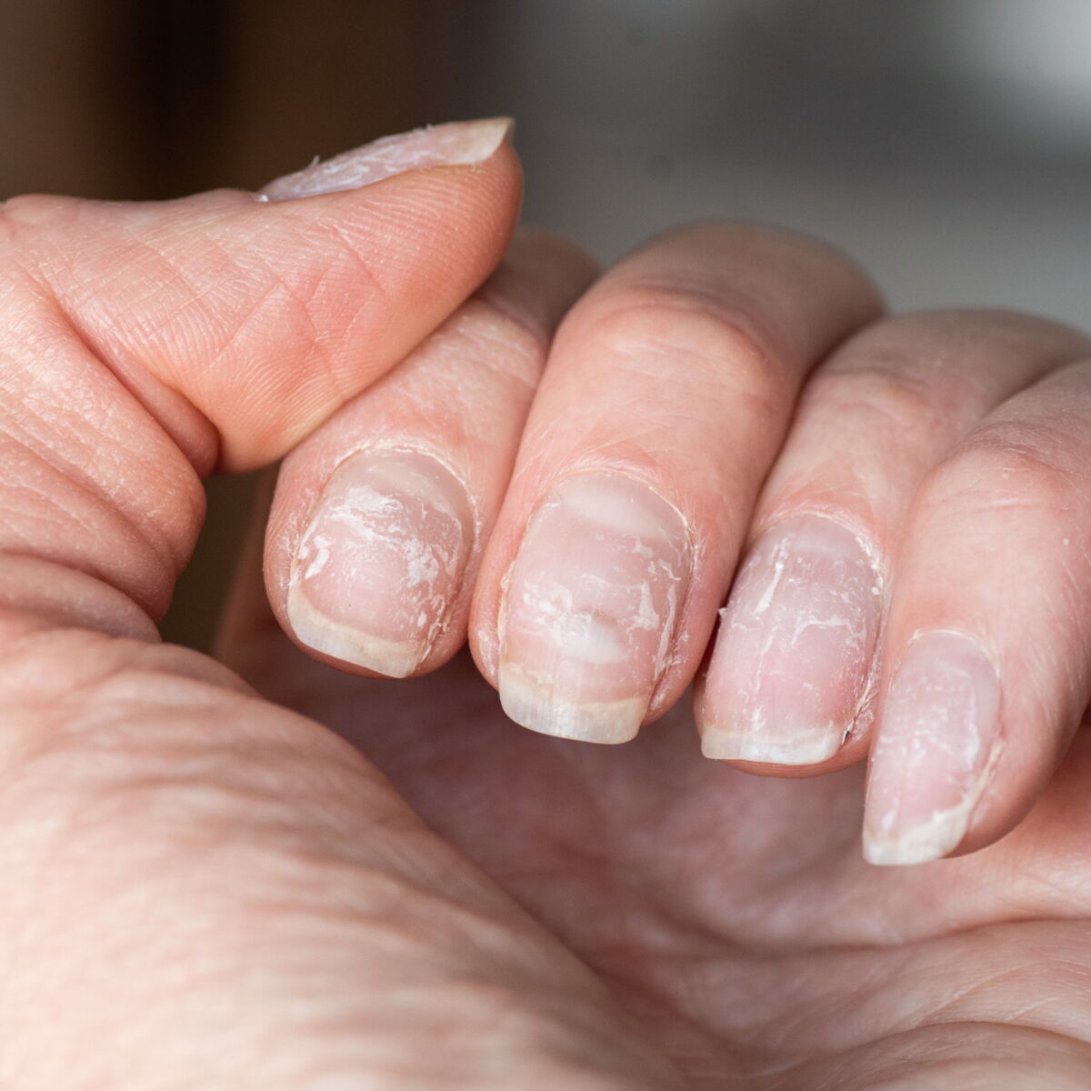 Quelle Est L39origine Des Taches Blanches Sur Les Ongles — free download