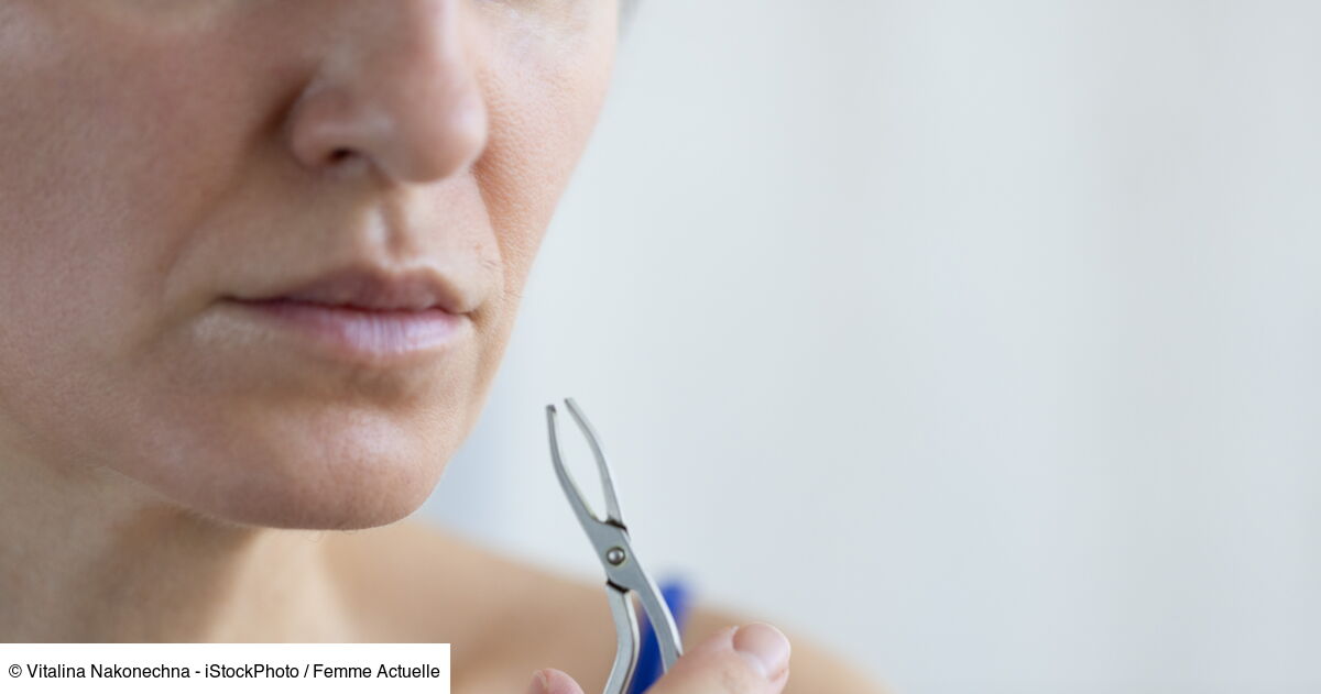 Poils au menton chez la femme : les conseils d'un dermatologue pour ...