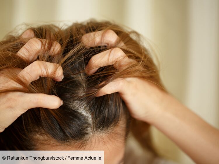 Quel shampoing utiliser pour apaiser les démangeaisons du cuir chevelu ?