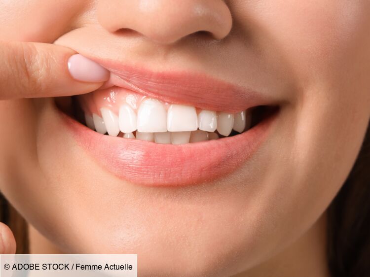 Brossettes dentaires ou hydropulseur, quelle solution privilégier en complément du brossage ? On a posé la question à un dentiste