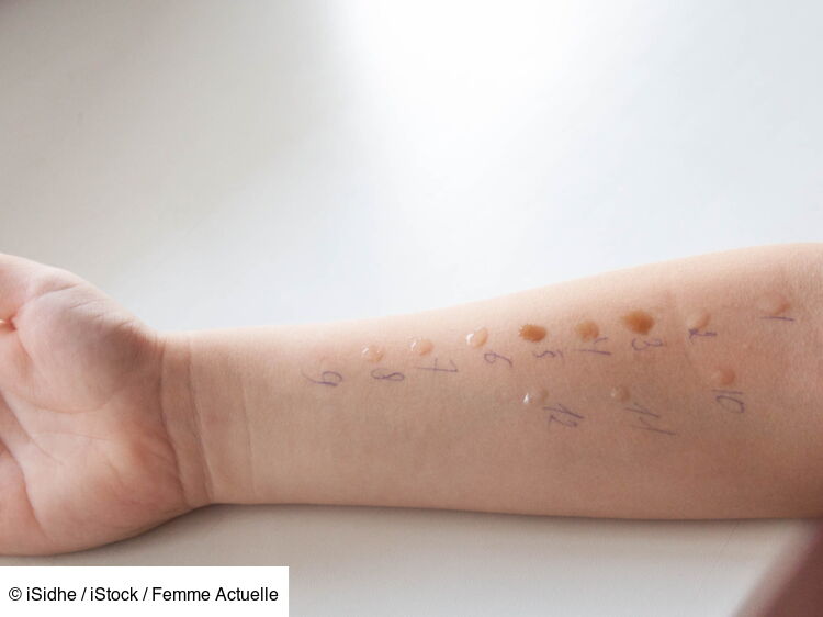 Identify Pollen Allergies: Expert Insights