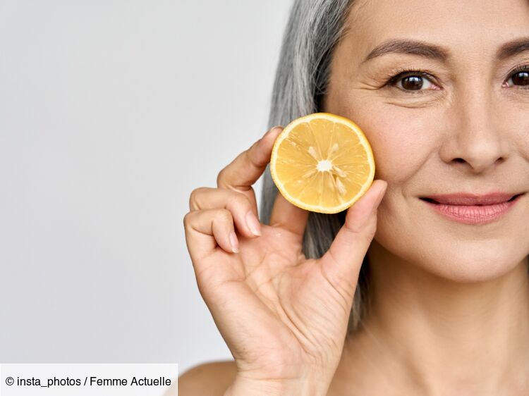 Peut-on appliquer du citron ou jus de citron sur son visage ? Une dermatologue répond