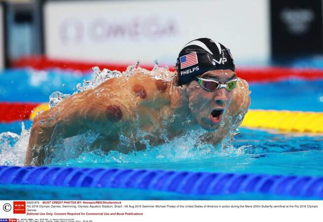 Michael Phelps et ses marques étranges 