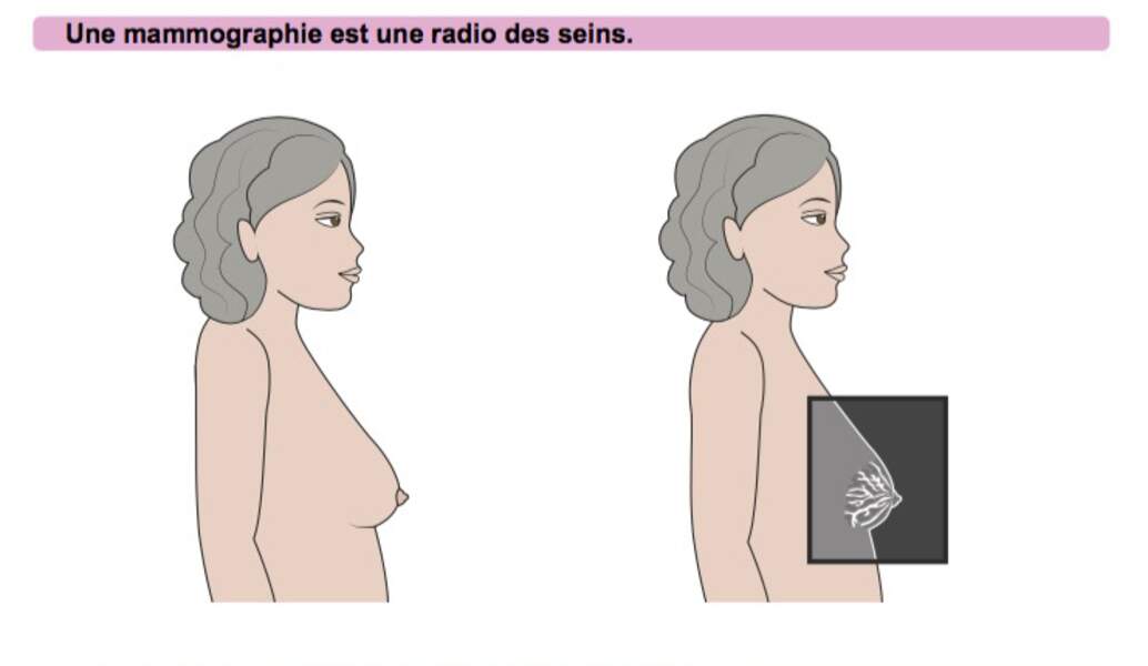 A quoi sert la mammographie ?