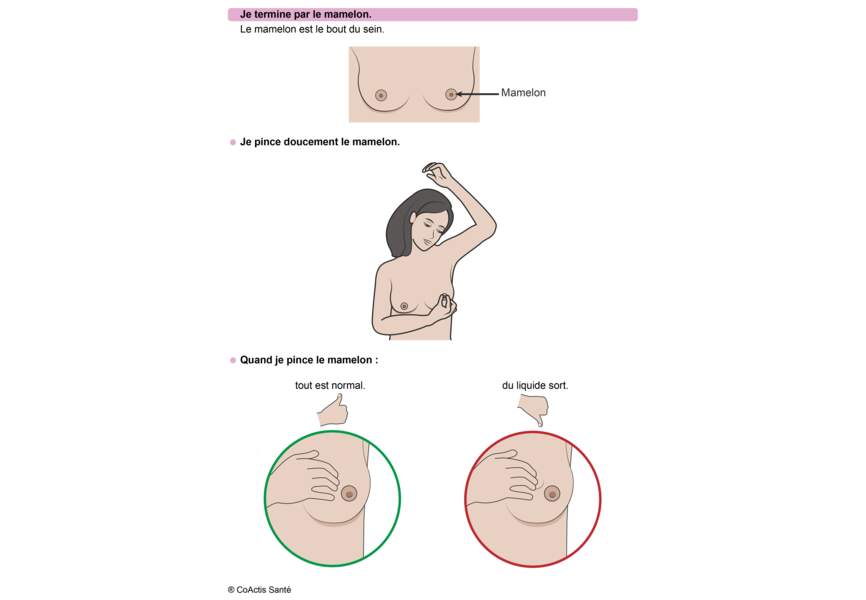 Etape 7 : vérifiez le mamelon