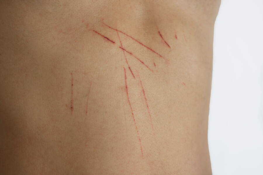 Zoonoses les maladies transmises par un animal de compagnie Femme