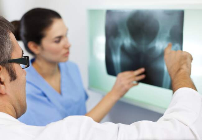Ostéoporose : pour les femmes de 60 ans et plus 