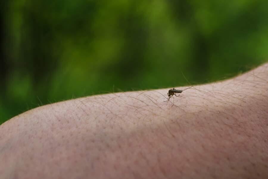 Bicarbonate de soude : un cataplasme contre les piqûres de moustiques