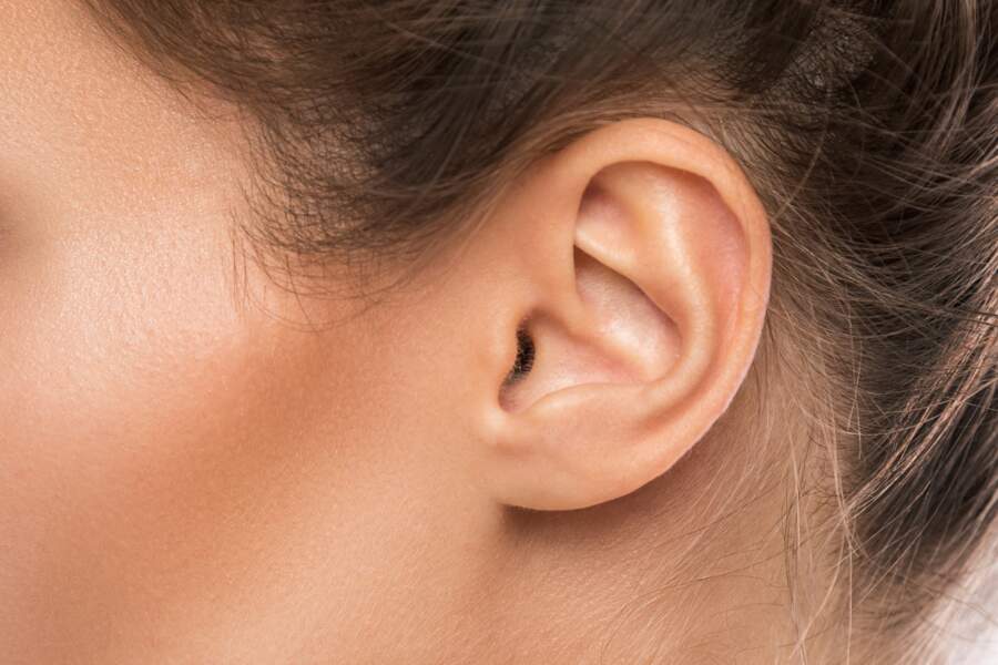 Un implant personnalisé pour recoller les oreilles