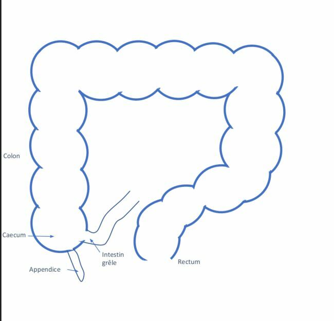 Schéma représentant l'appendice vermiculaire
