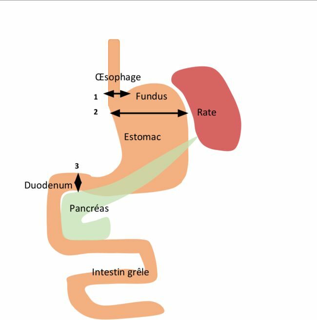 Cette figure montre les rapports anatomiques de l’estomac avec ses organes avoisinants. La flèche a représente la zone de section en haut en cas de gastrectomie totale alors que la flèche b montre la zone de section en haut en cas de gastrectomie des 4/5ème. La flèche c représente la zone de section en bas sur le duodénum.